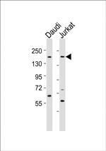 BZRAP1 Antibody in Western Blot (WB)