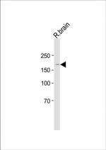 BZRAP1 Antibody in Western Blot (WB)