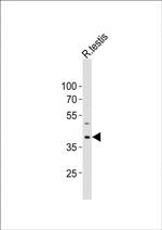 PCGF6 Antibody in Western Blot (WB)