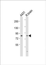 NGEF Antibody in Western Blot (WB)