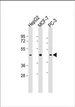 SAPCD2 Antibody in Western Blot (WB)