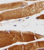 Titin Antibody in Immunohistochemistry (Paraffin) (IHC (P))