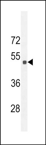 SESN2 Antibody in Western Blot (WB)