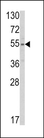 SLC38A3 Antibody in Western Blot (WB)