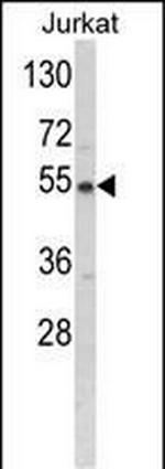 BCKDHA Antibody in Western Blot (WB)