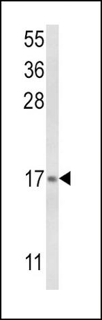 LTC4S Antibody in Western Blot (WB)