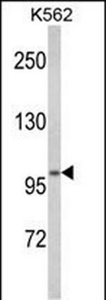 ATP12A Antibody in Western Blot (WB)