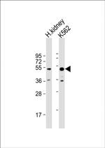 ALDH3B1 Antibody in Western Blot (WB)