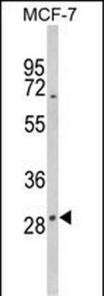 DIO2 Antibody in Western Blot (WB)