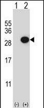 CTHRC1 Antibody in Western Blot (WB)