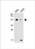 B4GALT1 Antibody in Western Blot (WB)