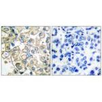 FGFR1OP Antibody in Immunohistochemistry (Paraffin) (IHC (P))