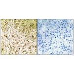 POLQ Antibody in Immunohistochemistry (Paraffin) (IHC (P))