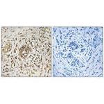 KIP2 Antibody in Immunohistochemistry (Paraffin) (IHC (P))