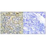 TNFAIP8 Antibody in Immunohistochemistry (Paraffin) (IHC (P))