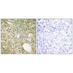 ACVRL1 Antibody in Immunohistochemistry (Paraffin) (IHC (P))