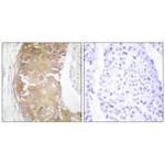 FRK Antibody in Immunohistochemistry (Paraffin) (IHC (P))