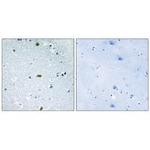 ZFHX3 Antibody in Immunohistochemistry (Paraffin) (IHC (P))