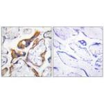 PHLDA2 Antibody in Immunohistochemistry (Paraffin) (IHC (P))