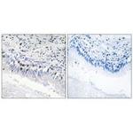 MED12 Antibody in Immunohistochemistry (Paraffin) (IHC (P))