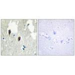 KLHL3 Antibody in Immunohistochemistry (Paraffin) (IHC (P))