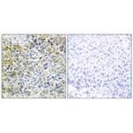 CARKL Antibody in Immunohistochemistry (Paraffin) (IHC (P))