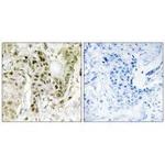 BCOR Antibody in Immunohistochemistry (Paraffin) (IHC (P))