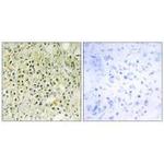 Galectin 8 Antibody in Immunohistochemistry (Paraffin) (IHC (P))