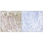 ACAD10 Antibody in Immunohistochemistry (Paraffin) (IHC (P))