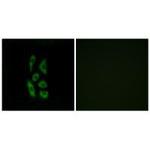 ACOT12 Antibody in Immunocytochemistry (ICC/IF)