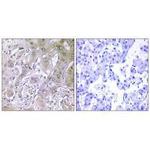 ACOT12 Antibody in Immunohistochemistry (Paraffin) (IHC (P))