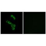 C1QB Antibody in Immunocytochemistry (ICC/IF)