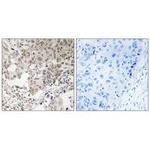 NCAPG2 Antibody in Immunohistochemistry (Paraffin) (IHC (P))