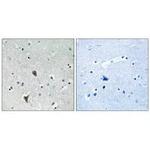 OXR1 Antibody in Immunohistochemistry (Paraffin) (IHC (P))