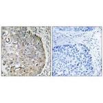 MRRF Antibody in Immunohistochemistry (Paraffin) (IHC (P))