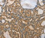 MPS1 Antibody in Immunohistochemistry (Paraffin) (IHC (P))