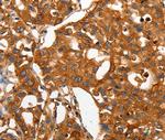 CAP2 Antibody in Immunohistochemistry (Paraffin) (IHC (P))