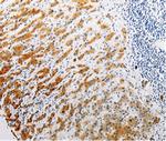 CLEC1B Antibody in Immunohistochemistry (Paraffin) (IHC (P))