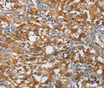 CRTAM Antibody in Immunohistochemistry (Paraffin) (IHC (P))