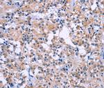 DUSP22 Antibody in Immunohistochemistry (Paraffin) (IHC (P))