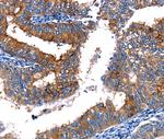 TBX22 Antibody in Immunohistochemistry (Paraffin) (IHC (P))