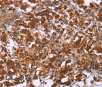 ING2 Antibody in Immunohistochemistry (Paraffin) (IHC (P))