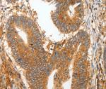 MMP28 Antibody in Immunohistochemistry (Paraffin) (IHC (P))