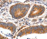 MYH7 Antibody in Immunohistochemistry (Paraffin) (IHC (P))