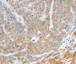 NTS Antibody in Immunohistochemistry (Paraffin) (IHC (P))