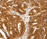 PDCD6 Antibody in Immunohistochemistry (Paraffin) (IHC (P))