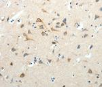 SCG3 Antibody in Immunohistochemistry (Paraffin) (IHC (P))