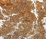 TFF2 Antibody in Immunohistochemistry (Paraffin) (IHC (P))