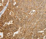 TFF2 Antibody in Immunohistochemistry (Paraffin) (IHC (P))