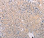 ABCF3 Antibody in Immunohistochemistry (Paraffin) (IHC (P))